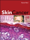 Skin Cancer - eBook