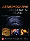 Ultrasonography of the Prenatal Brain, Third Edition - Book