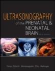 Ultrasonography of the Prenatal Brain, Third Edition - eBook