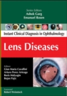 Lens Diseases - Book