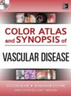 Color Atlas and Synopsis of Vascular Disease - eBook