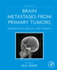 Brain Metastases from Primary Tumors, Volume 2 : Epidemiology, Biology, and Therapy - eBook