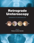 Retrograde Ureteroscopy : Handbook of Endourology - eBook