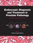 Endoscopic Diagnosis and Treatment in Prostate Pathology : Handbook of Endourology - eBook