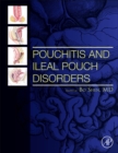 Pouchitis and Ileal Pouch Disorders : A Multidisciplinary Approach for Diagnosis and Management - Book