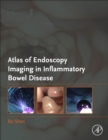 Atlas of Endoscopy Imaging in Inflammatory Bowel Disease - Book