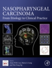 Nasopharyngeal Carcinoma : From Etiology to Clinical Practice - eBook