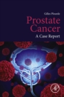 Prostate Cancer : A Case Report - eBook