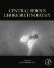 Central Serous Chorioretinopathy - eBook