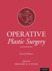 Operative Plastic Surgery - Book