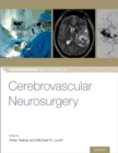 Cerebrovascular Neurosurgery - eBook