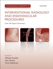 Challenging Concepts in Interventional Radiology - eBook