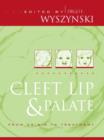 Cleft Lip and Palate : From Origin to Treatment - Book