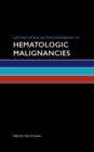 Oxford American Mini-Handbook of Hematologic Malignancies - Book