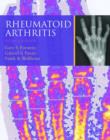 Rheumatoid Arthritis - Book