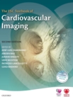 The ESC Textbook of Cardiovascular Imaging - Book