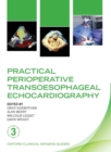 Practical Perioperative Transoesophageal Echocardiography - Book