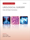 Challenging Cases in Urological Surgery - Book
