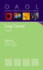 Lung Cancer - eBook