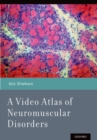 A Video Atlas of Neuromuscular Disorders - eBook