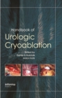 Handbook of Urologic Cryoablation - eBook