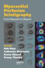 Myocardial Perfusion Scintigraphy : From Request to Report - eBook