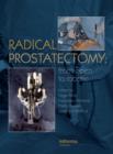 Radical Prostatectomy : From Open to Robotic - eBook