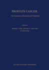 Prostate Cancer: New Horizons in Research and Treatment - eBook