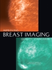 Improving Breast Imaging Quality Standards - Book