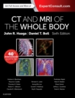 Computed Tomography & Magnetic Resonance Imaging Of The Whole Body E-Book - eBook