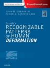 Smith's Recognizable Patterns of Human Deformation - Book