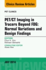 PET/CT Imaging in Tracers Beyond FDG, An Issue of PET Clinics - eBook