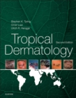 Tropical Dermatology E-Book - eBook