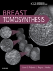 Breast Tomosynthesis - Book