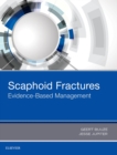 Scaphoid Fractures : Evidence-Based Management - eBook