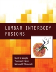 Lumbar Interbody Fusions E-Book - eBook