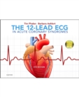 The 12-Lead ECG in Acute Coronary Syndromes - Book