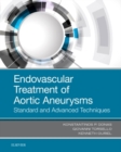 Endovascular Treatment of Aortic Aneurysms : Standard and Advanced Techniques - Book