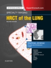 Specialty Imaging: HRCT of the Lung E-Book : Specialty Imaging: HRCT of the Lung E-Book - eBook