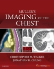 Muller's Imaging of the Chest E-Book : Expert Radiology Series - eBook