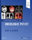 Fundamentals of Oncologic PET/CT - Book
