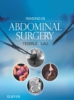 Imaging in Abdominal Surgery : Imaging in Abdominal Surgery E-Book - eBook