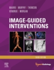 Image-Guided Interventions : Expert Radiology Series - eBook