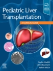 Pediatric Liver Transplantation : A Clinical Guide - Book