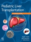 Pediatric Liver Transplantation : A Clinical Guide - eBook