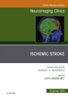 Ischemic Stroke, An Issue of Neuroimaging Clinics of North America - eBook