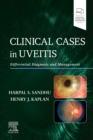 Clinical Cases in Uveitis : Differential Diagnosis and Management - Book