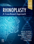 Rhinoplasty : a Case-based approach - eBook