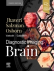 Diagnostic Imaging: Brain - Book