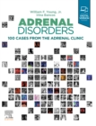Adrenal Disorders : Cases from the Adrenal Clinic - eBook